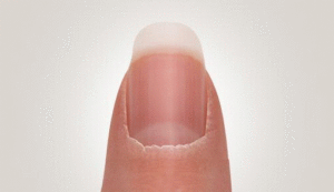 Nagelhaut